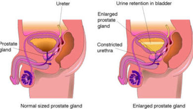 Must Read!! All The Education You Need About Prostrate Disease